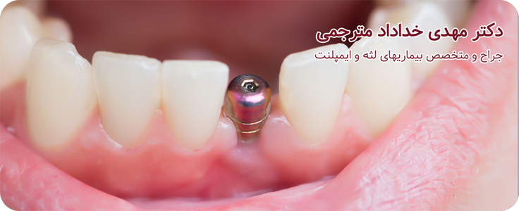 وبسایت دندانپزشکی